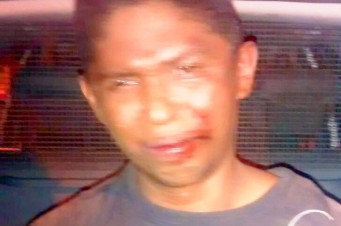 Cão ataca ladrão