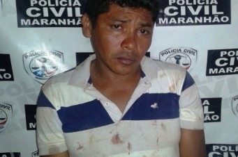 Homem agride companheira em Zé Doca