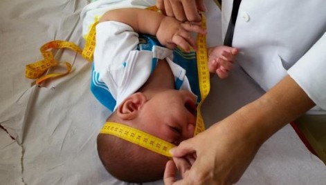 Para Thomaz Gollop as crian&ccedil;as com per&iacute;metro encef&aacute;lico menor que o padr&atilde;o deveriam ser encaminhadas para uma ultrassonografia do sistema nervoso 