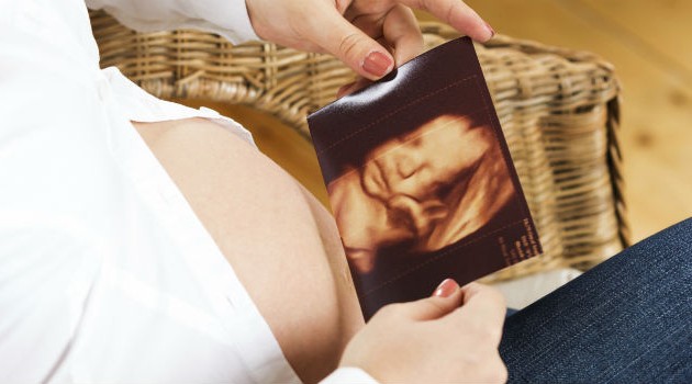 Imagens que asseguram a sa&uacute;de das futuras mam&atilde;es e dos beb&ecirc;s  