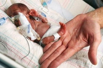 A menor beb&ecirc; do mundo