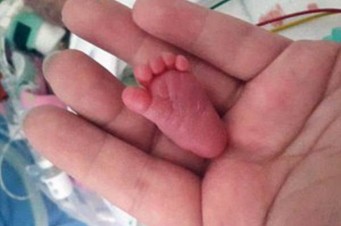 A menor beb&ecirc; do mundo